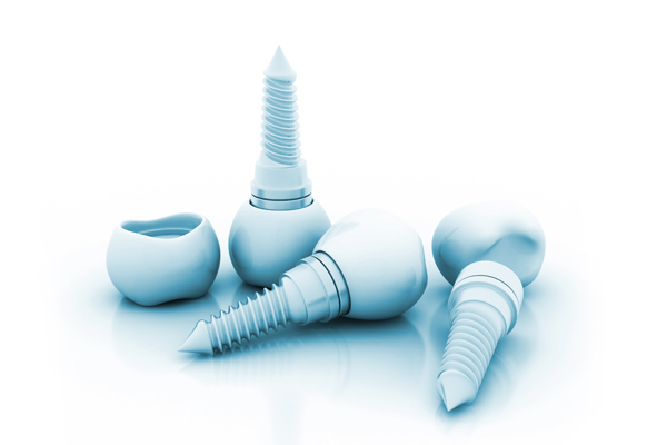 Implant Crowns Vs  Traditional Crowns: What Patients Should Understand